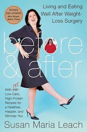 Before and After: Living and Eating Well After Weight-loss Surgery (Paperback)