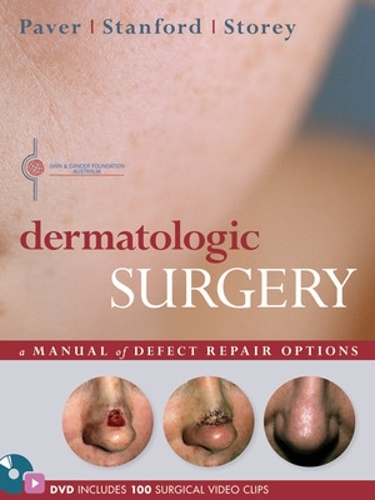 Dermatologic Surgery (Hardback)