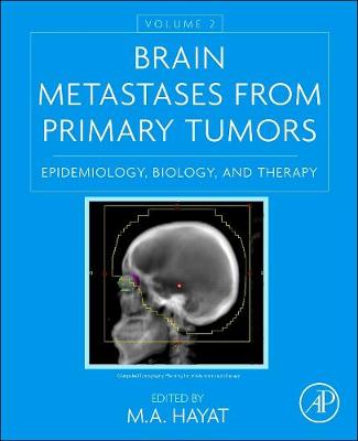 Brain Metastases from Primary Tumors, Volume 2: Epidemiology, Biology, and Therapy (Hardback)
