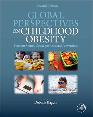 Global Perspectives on Childhood Obesity by Debasis Bagchi | Waterstones