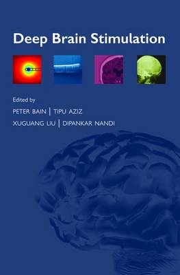 Deep Brain Stimulation (Paperback)