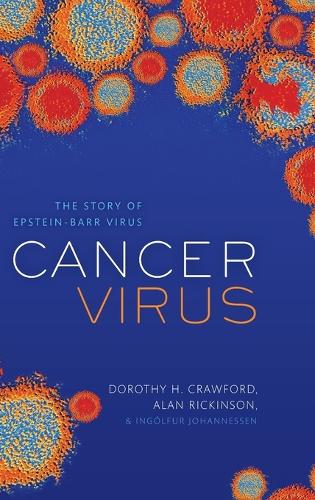 Cancer Virus: The story of Epstein-Barr Virus (Hardback)