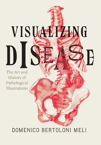Visualizing Disease: The Art and History of Pathological Illustrations (Hardback)