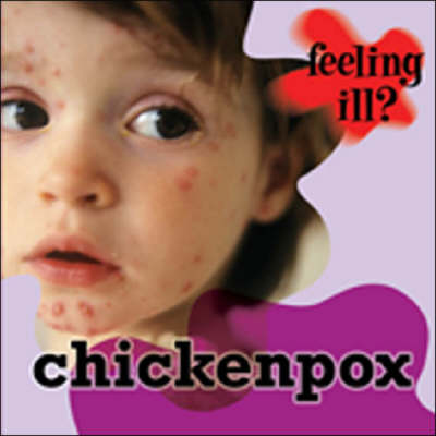 Chicken Pox - Feeling Ill? (Hardback)