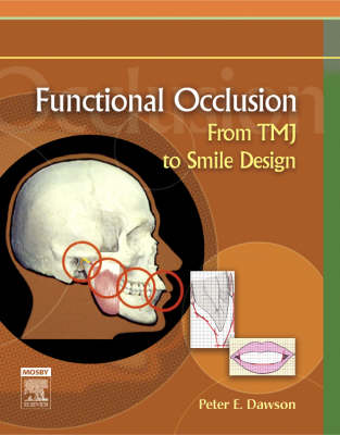 Functional Occlusion: From TMJ to Smile Design (Hardback)