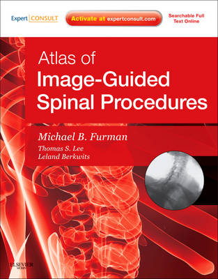 Atlas of Image-Guided Spinal Procedures (Hardback)