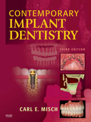 Contemporary Implant Dentistry (Hardback)