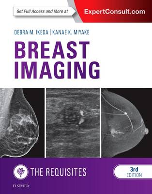 Breast Imaging: The Requisites - Requisites in Radiology (Hardback)