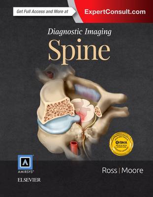 Diagnostic Imaging: Spine - Diagnostic Imaging (Hardback)