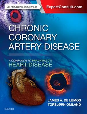 Chronic Coronary Artery Disease: A Companion to Braunwald's Heart Disease - Companion to Braunwald's Heart Disease (Hardback)