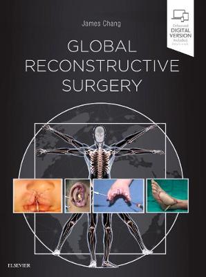 Global Reconstructive Surgery (Hardback)