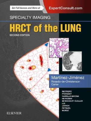 Specialty Imaging: HRCT of the Lung - Specialty Imaging (Hardback)