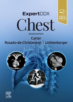 ExpertDDx: Chest (Hardback)