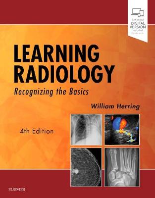 Learning Radiology: Recognizing the Basics (Paperback)