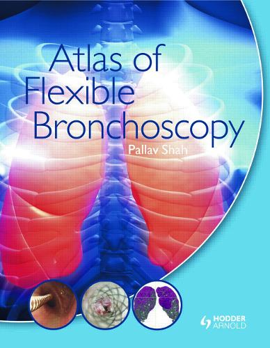 Atlas of Flexible Bronchoscopy (Hardback)