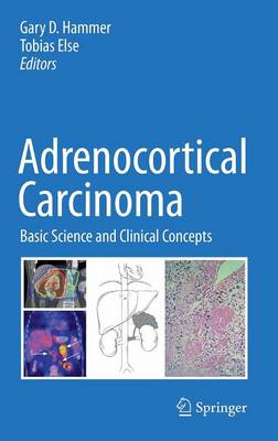 Adrenocortical Carcinoma: Basic Science and Clinical Concepts (Hardback)