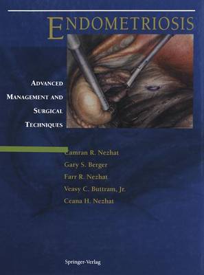 Endometriosis: Advanced Management and Surgical Techniques (Hardback)
