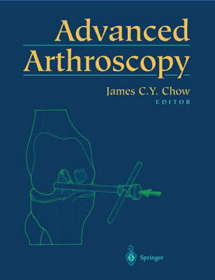 Advanced Arthroscopy (Hardback)