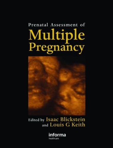 Prenatal Assessment of Multiple Pregnancy (Hardback)