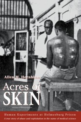 Acres of Skin: Human Experiments at Holmesburg Prison (Paperback)