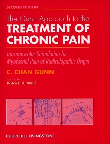 The Gunn Approach to the Treatment of Chronic Pain: Intramuscular Stimulation for Myofascial Pain of Radiculopathic Origin (Hardback)
