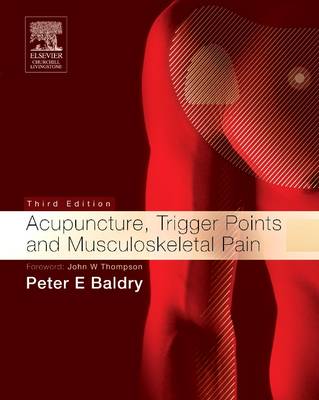 Cover Acupuncture, Trigger Points and Musculoskeletal Pain