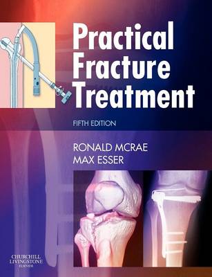 Practical Fracture Treatment (Paperback)