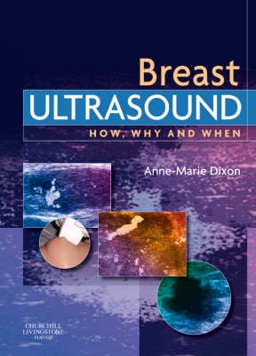 Breast Ultrasound: How, Why and When - How, Why and When (Hardback)