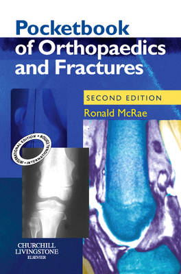Pocketbook of Orthopaedics and Fractures (Paperback)
