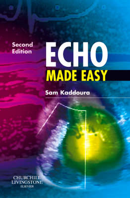 Echo Made Easy - Made Easy (Paperback)