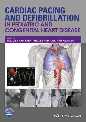 Cardiac Pacing and Defibrillation in Pediatric and Congenital Heart Disease (Hardback)