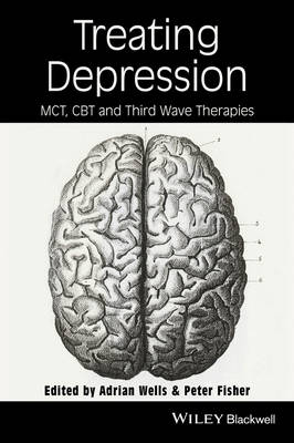 Treating Depression: MCT, CBT and Third Wave Therapies (Paperback)