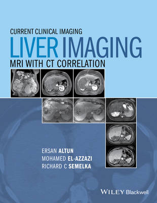 Liver Imaging: MRI with CT Correlation - Current Clinical Imaging (Hardback)