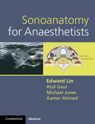 Sonoanatomy for Anaesthetists (Spiral bound)