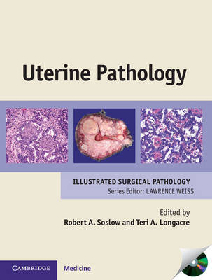 Uterine Pathology - Cambridge Illustrated Surgical Pathology (Hardback)
