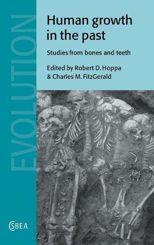 Human Growth in the Past: Studies from Bones and Teeth - Cambridge Studies in Biological and Evolutionary Anthropology 25 (Hardback)