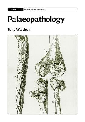 Palaeopathology - Cambridge Manuals in Archaeology (Paperback)