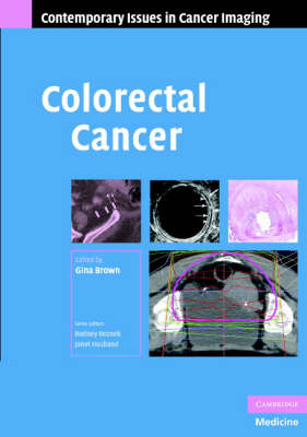 Colorectal Cancer - Contemporary Issues in Cancer Imaging (Hardback)