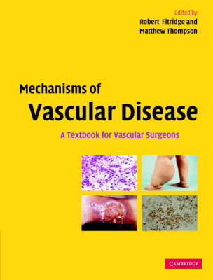 Mechanisms of Vascular Disease: A Textbook for Vascular Surgeons (Hardback)