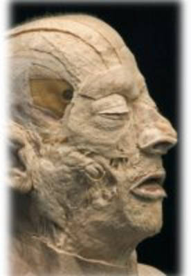 Head and Neck: Tutorials of Head and Neck (CD-ROM)
