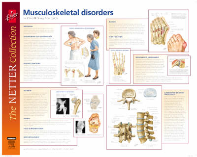 Frank H. Netter Musculoskeletal Disorders Poster - European Netter Poster Series (Poster)