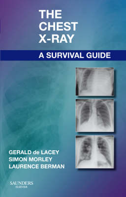 The Chest X-Ray: A Survival Guide - Gerald de Lacey