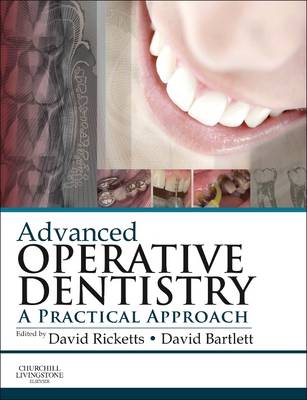 Advanced Operative Dentistry: A Practical Approach (Paperback)