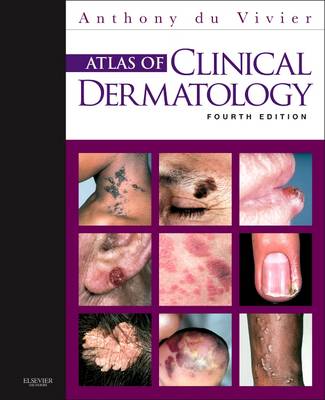 Atlas of Clinical Dermatology (Hardback)