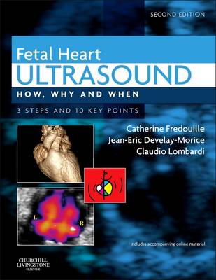 Fetal Heart Ultrasound: How, Why and When - How, Why and When (Hardback)