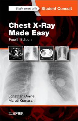 Chest X-Ray Made Easy - Made Easy (Paperback)