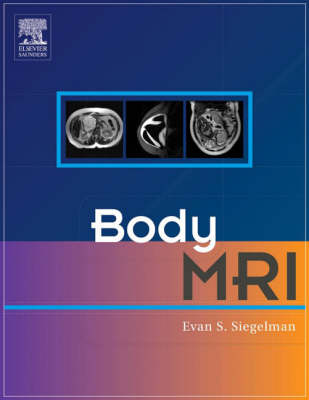 Body MRI (Hardback)