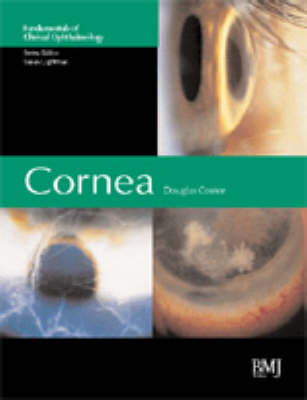 Cornea - Fundamentals in Clinical Ophthalmology (Hardback)