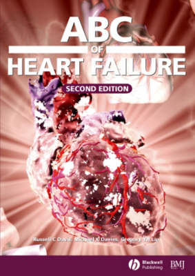 ABC of Heart Failure - ABC S. (Paperback)