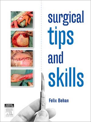Surgical Tips and Skills (Paperback)